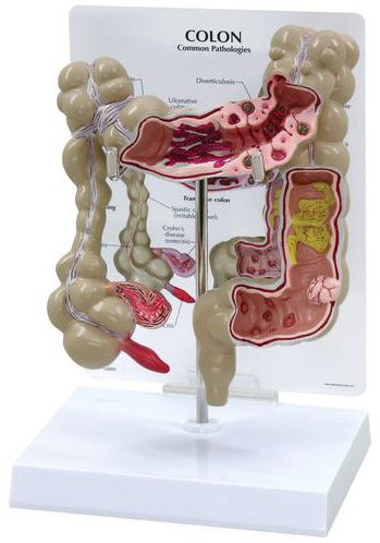 Maqueta de Colon Marca 3Bscientific Modelo 3340