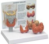 Modelo de tiroides 3Bscientific 1019548 [W33370]