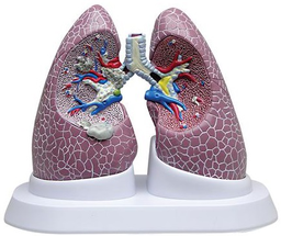 Maqueta de Pulmón con Patologías Marca 3bscientific Modelo 1018749 [W33371]